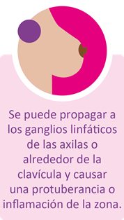 Hoy se celebra el Día Mundial de Lucha contra el Cáncer de Mama seno08
