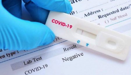 El Gobierno distribuye un millón más de test rápidos de detección de anticuerpos para diagnosticar de forma precoz el COVID-19