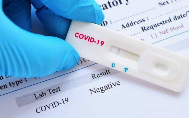 El Gobierno distribuye un millón más de test rápidos de detección de anticuerpos para diagnosticar de forma precoz el COVID-19